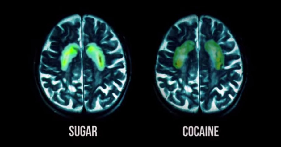 How Sugar Affects The Brain